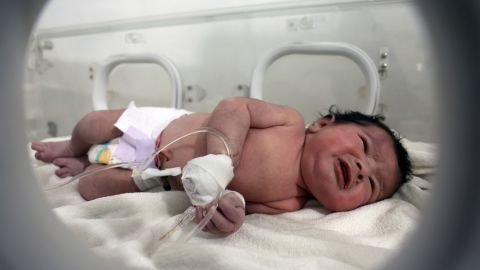 bayi perempuan baru lahir yang diselamatkan dari puing-puing rumahnya dilarikan ke rumah sakit anak di kota Afrin (CNN)